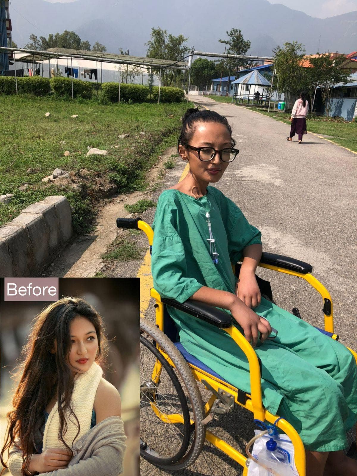 Late Nurse Anjali Shrestha